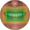 Figure 10b  The size of the digital sensor that captures the image in most digital SLR cameras (green) is proportionally much smaller than the corresponding size of a frame of 35 mm film in an SLR camera (yellow).