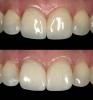 Figure 14  Note the lack of shadow and plasticity of the ring flash photo (top). The twin flash photo (bottom) shows soft, uniform illumination that reveals surface detail and color transitions.