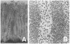 Figure 3  Structural features of thick human supragingival plaque. Transmission electron micrographs of biofilms formed on a removable artificial molar. (A) Low magnification image of 1-week-old plaque comprised of adjacent palisades. (B) High magnification image shows detailed structure within adjacent palisades. (Bar = 1 ¬µm.) Used with permission from Wiley-Blackwell. Listgarten MA. The structure of dental plaque. Periodontol 2000. 1994;5:552-565.