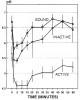 Figure 6 Stephan curves showing sucrose-induced pH change within plaque on a sound tooth surface, in an inactive caries lesion, and in an active caries lesion. Used with permission from Sage Publications. Fejerskov O, Scheie AA, Manji, F. The effect of sucrose on plaque pH in the primary and permanent dentition of caries-inactive and active Kenyan children. J Dent Res. 1992;71(1):25-31.