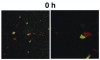 Figure 7c  Right panel in each pair is a 3x zoom of the left panel. A large amount of biomass is produced, and the two cell types form interdigitated colonies..