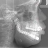 Figure 7  Cephalometric x-ray with an analysis of facial form, vertical dimension, and incisor position.