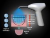 Figure 3  Diagram of degree of conversion, depth of cure, and shape of cure of RBC by light-curing unit.