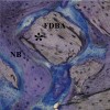 Figure 17  Photomicrograph showing evidence (*) of new bone repopulating a region of a graft particle. Original magnification X 10; toluidine blue stain.