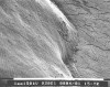 Figure 2  CEJ of mandibular first bicuspid extracted for orthodontic reasons. Enamel exhibits a slightly roughened and porous surface. The ledge-like junction of enamel and cementum and surface textures likely contribute to biofilm and calculus retention. Bar = 1 mm at an original magnification of 93x.