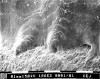 Figure 3  Irregular contours of enamel at the CEJ, rough and prominent perikymata, and tunnel-like area where enamel overlaps the cementum (arrow) all contribute to retention of biofilm and dental calculus. Bar = 0.1 mm at an original magnification of 186x.