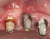 Figure 2  Site No. 10 has a mucosal margin.