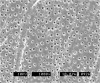 Figure 2  Treatment of dentin with phosphoric acid (37% for 15 seconds) removes the smear layer, causes a superficial demineralization of the intertubular dentin, and exposes and opens dentin tubules. (SEM courtesy of Jenny Wang.)