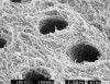 Figure 5  Superior view of exposed collagen fibers after demineralization with phosphoric acid; dentin has been left moist. Primers and resins should completely penetrate collagen fibers. (SEM courtesy of Dr. Franklin Tay.)
